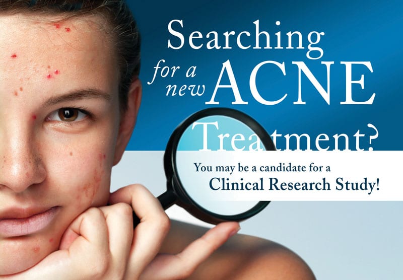 clinical research ad